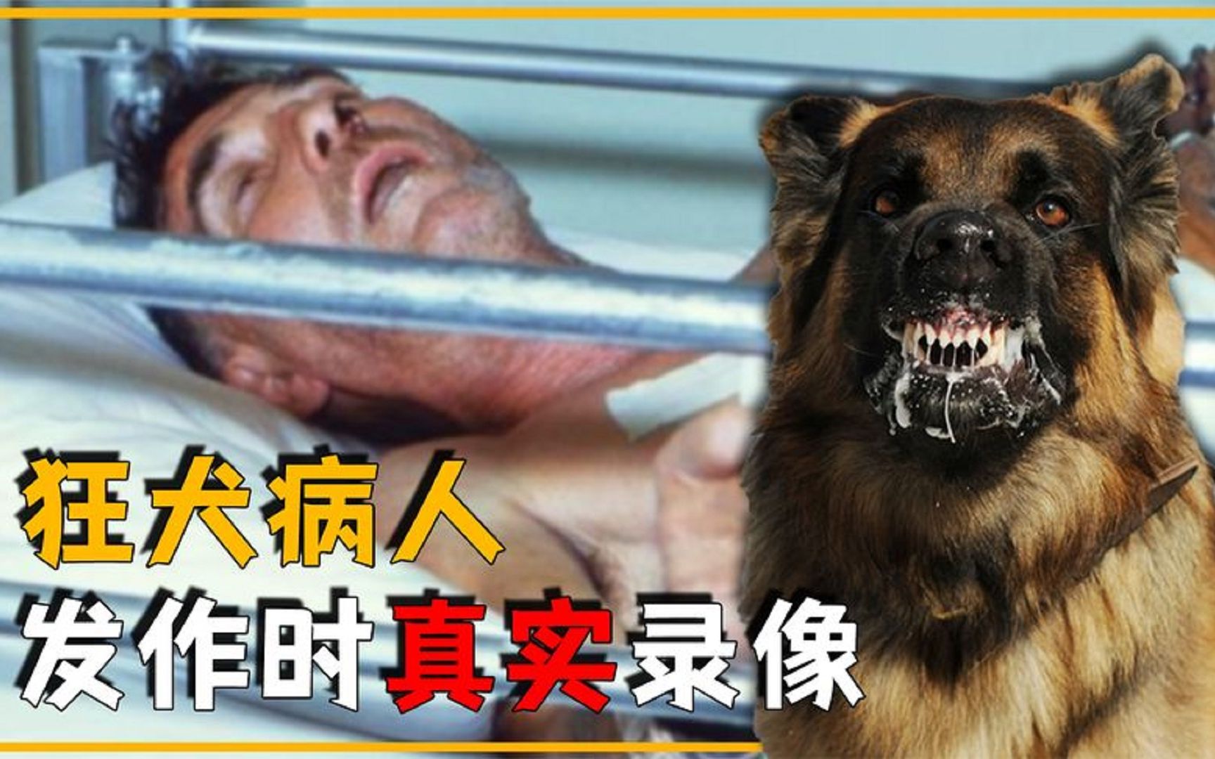 狂犬病患者发作时,全过程的真实录像,狂犬病毒究竟有多恐怖?哔哩哔哩bilibili