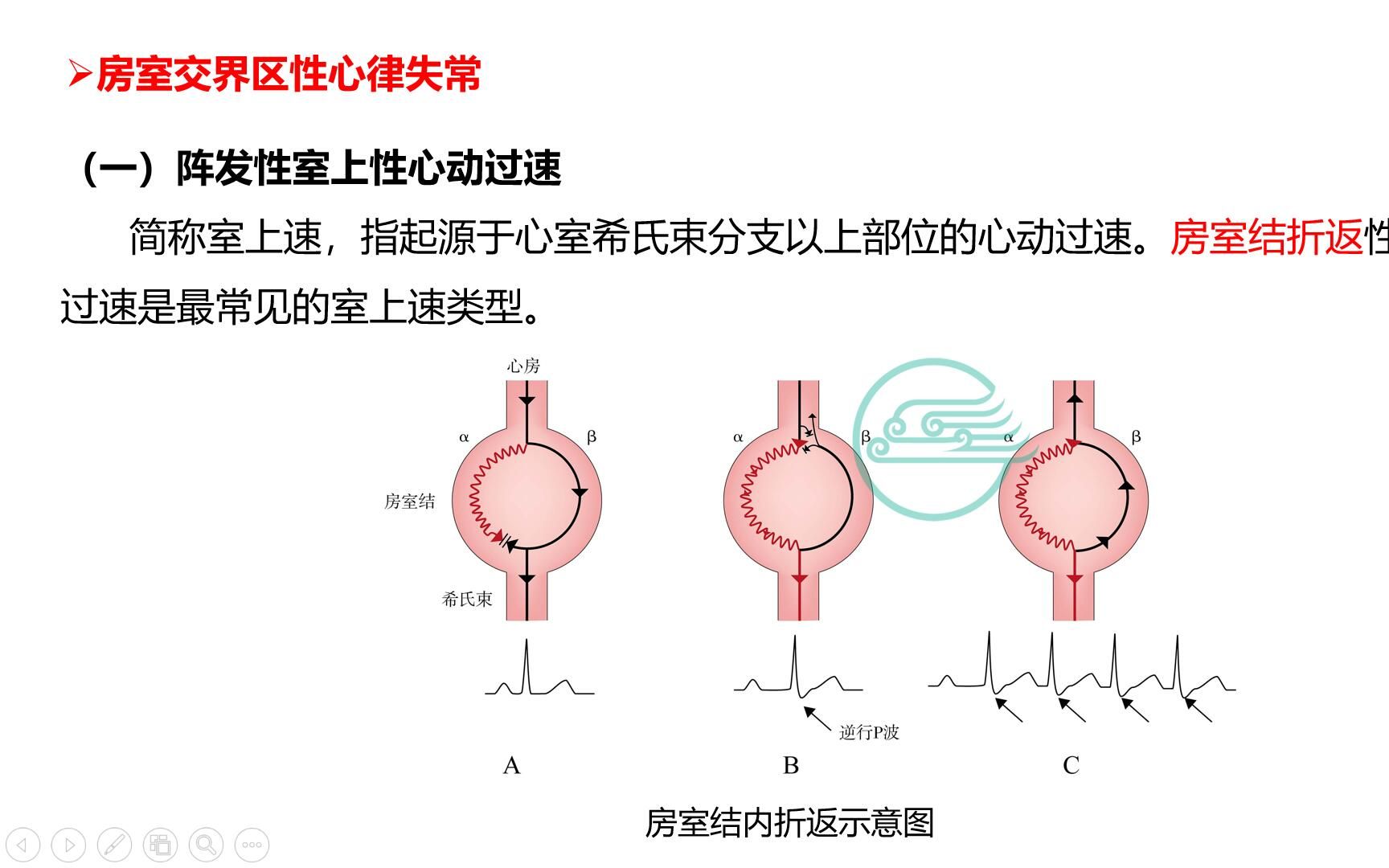 [图]3、心律失常--室上速