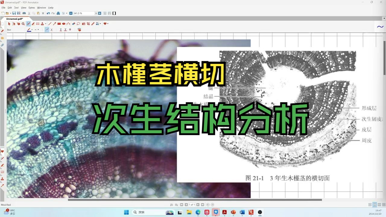 【植物学】木槿茎横切面的次生结构分析