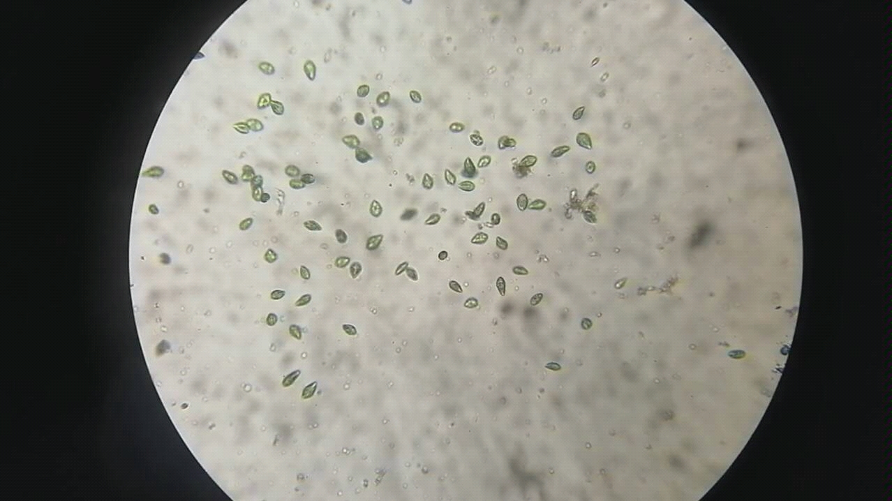 光学显微镜简易装片10倍数藻类