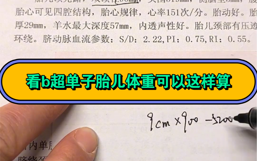 看b超单子胎儿体重可以这样估算!你学会了吗?哔哩哔哩bilibili