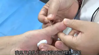 Descargar video: 手指疼,腱鞘炎,类风湿,一组穴位解决!董氏奇穴