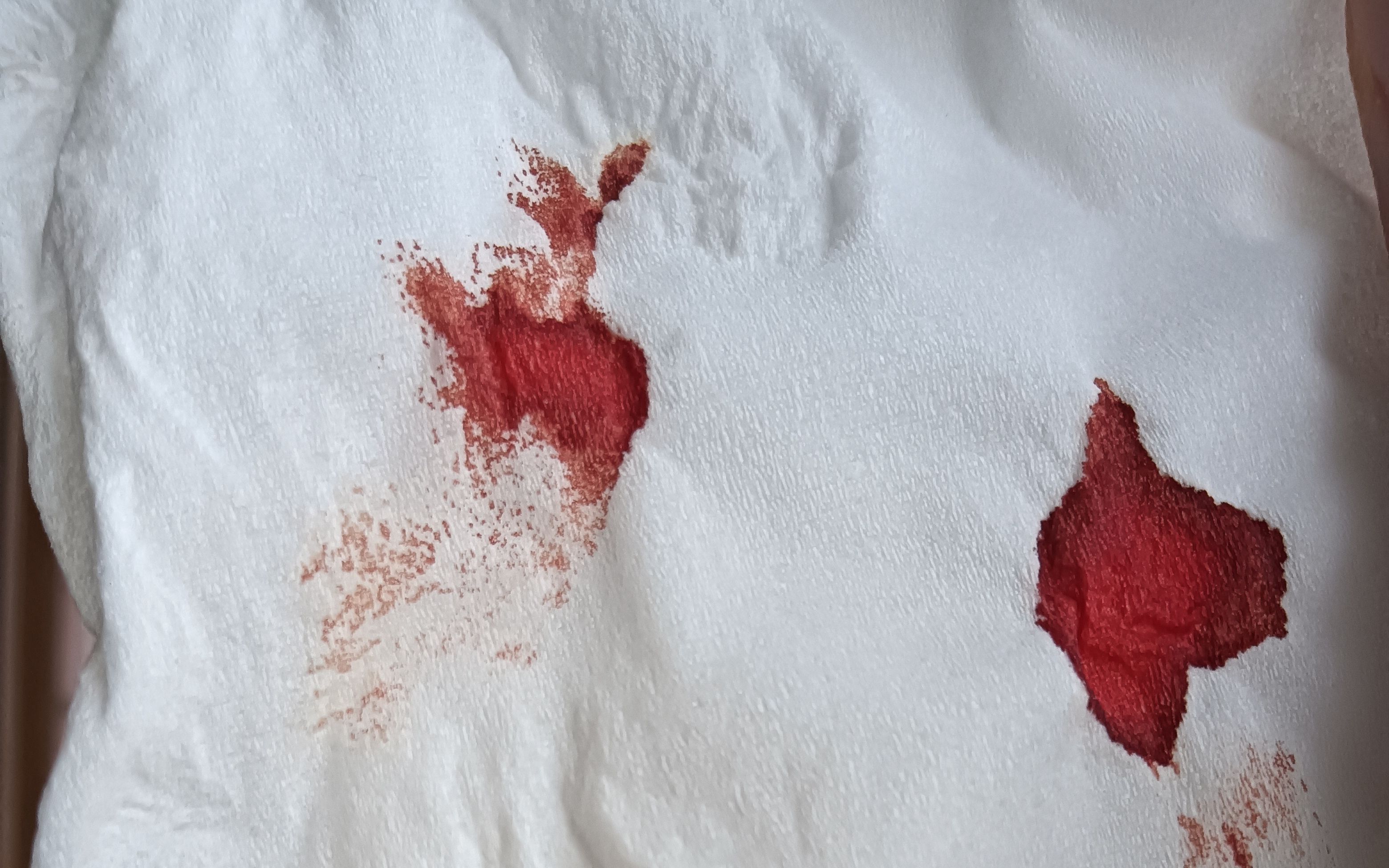 血凝固后的样子