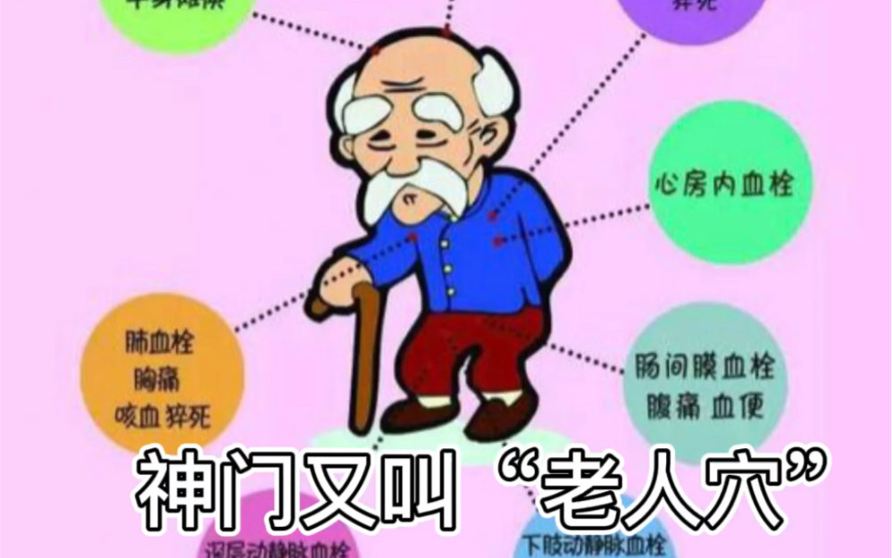 [图]神门穴的前世今生