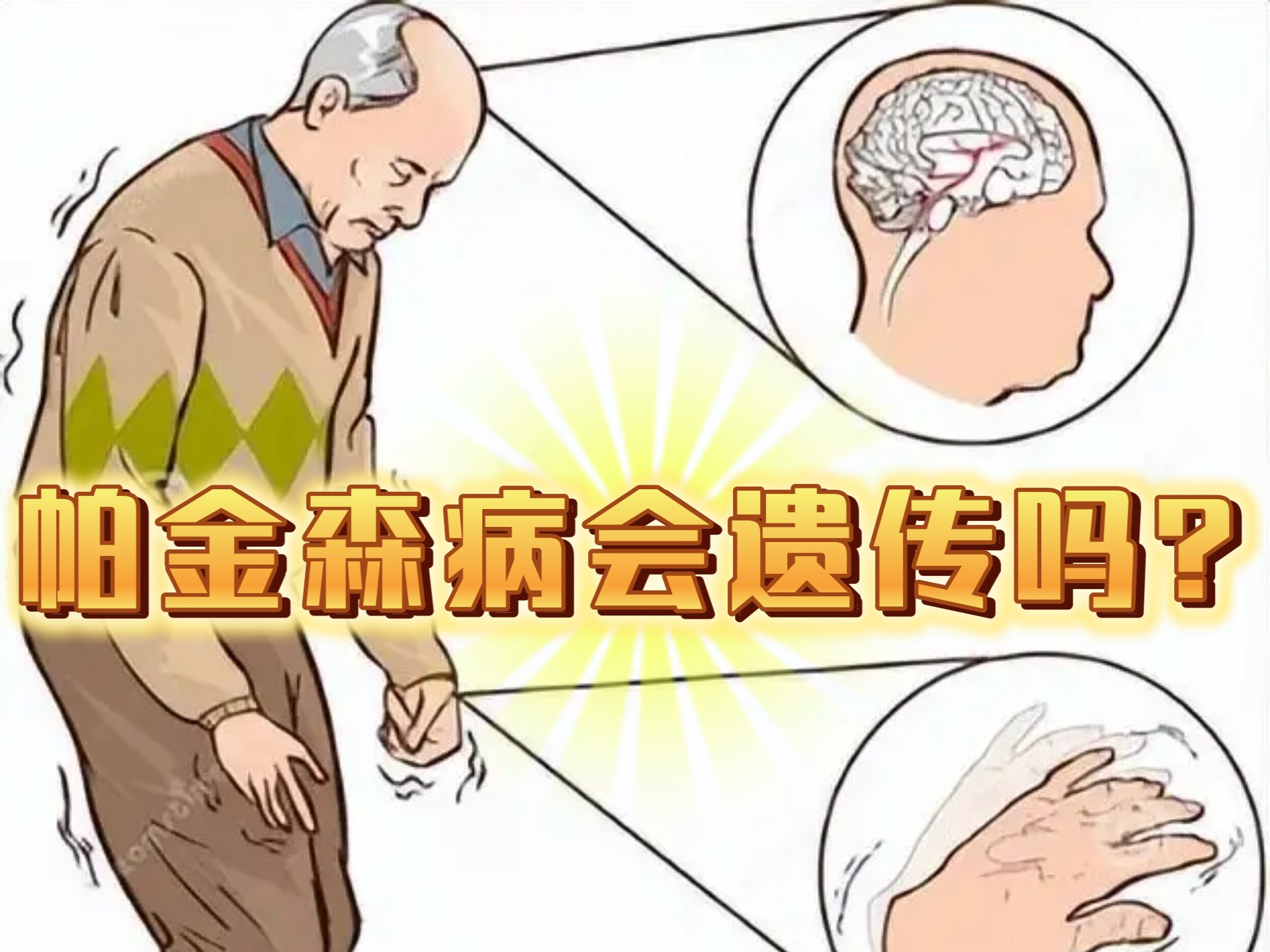 为什么会得帕金森这个病为什么在线