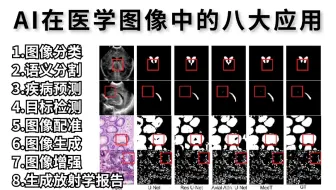 人工智能在医疗图像领域实现应用落地的算法有哪些？未来发展如何？听完计算机大佬讲课后直接茅塞顿开！——目标检测、图像生成、语义分割