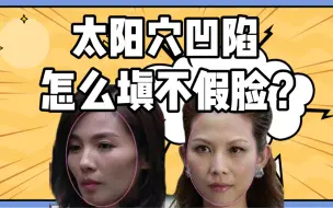 Download Video: 太阳穴凹陷怎么办？正确填充到哪里？