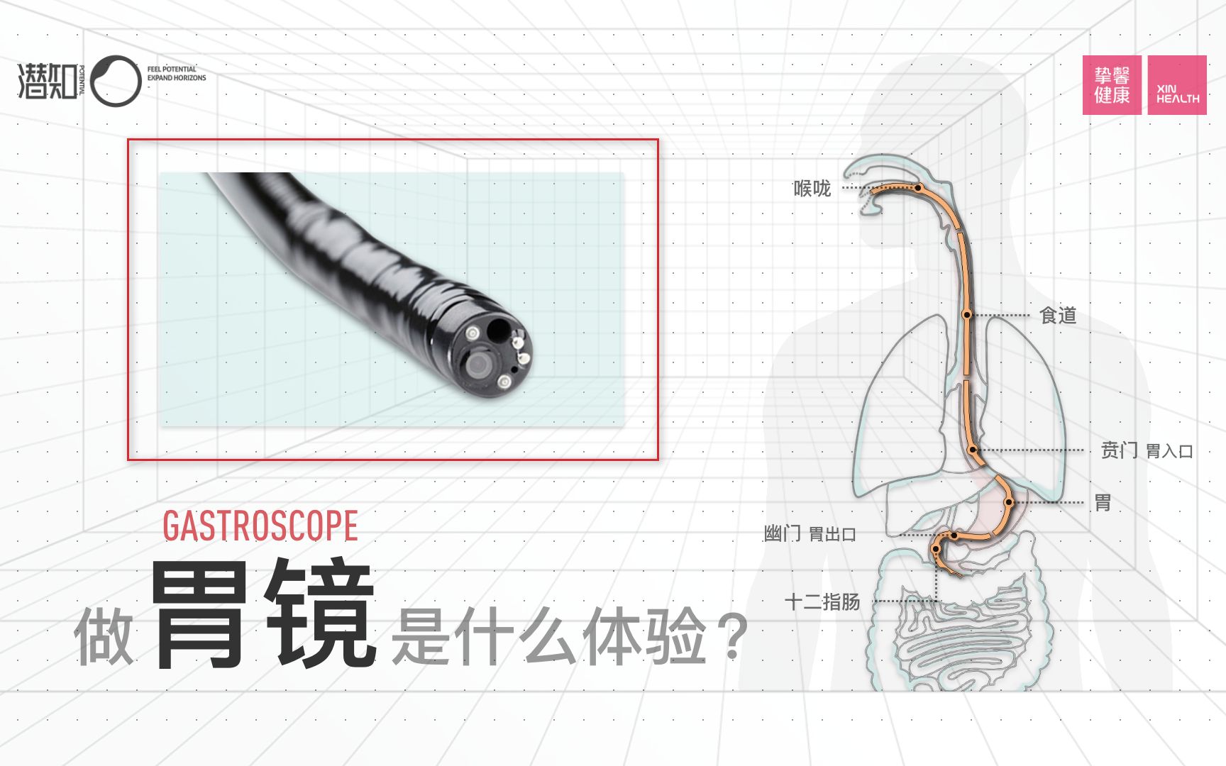 做胃镜是一种什么体验?到底痛不痛?哔哩哔哩bilibili