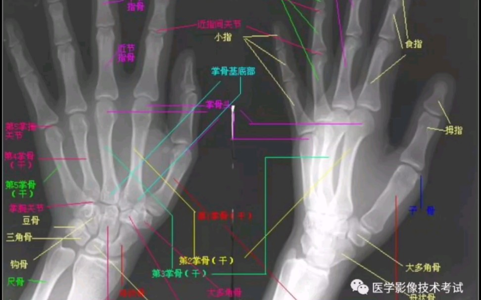 [图]影像生必备的x线解剖图谱，医学影像技术考试