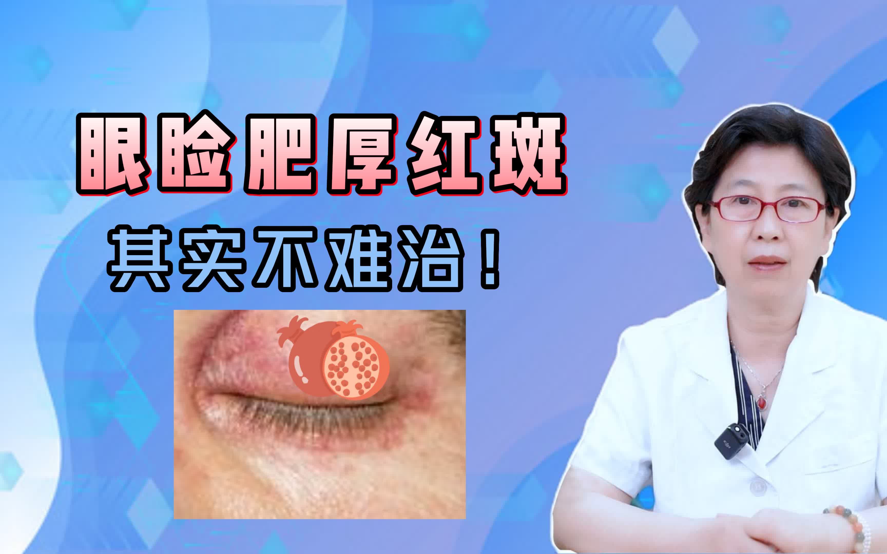 眼睑长出肥厚红斑还特别痒,这其实并不难治哔哩哔哩bilibili