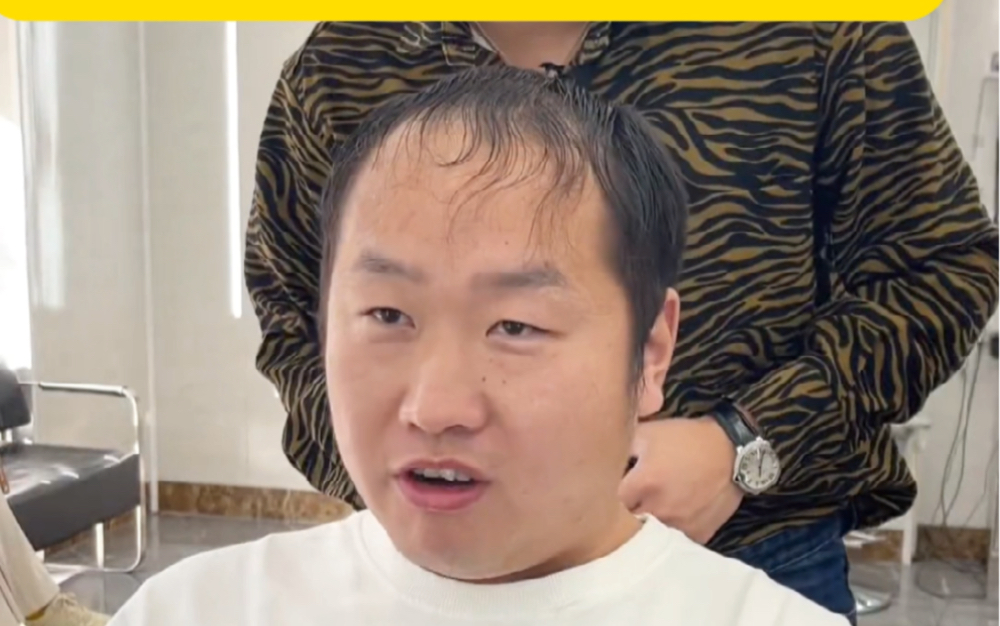 大哥大连来成都只为拯救高额头发际线