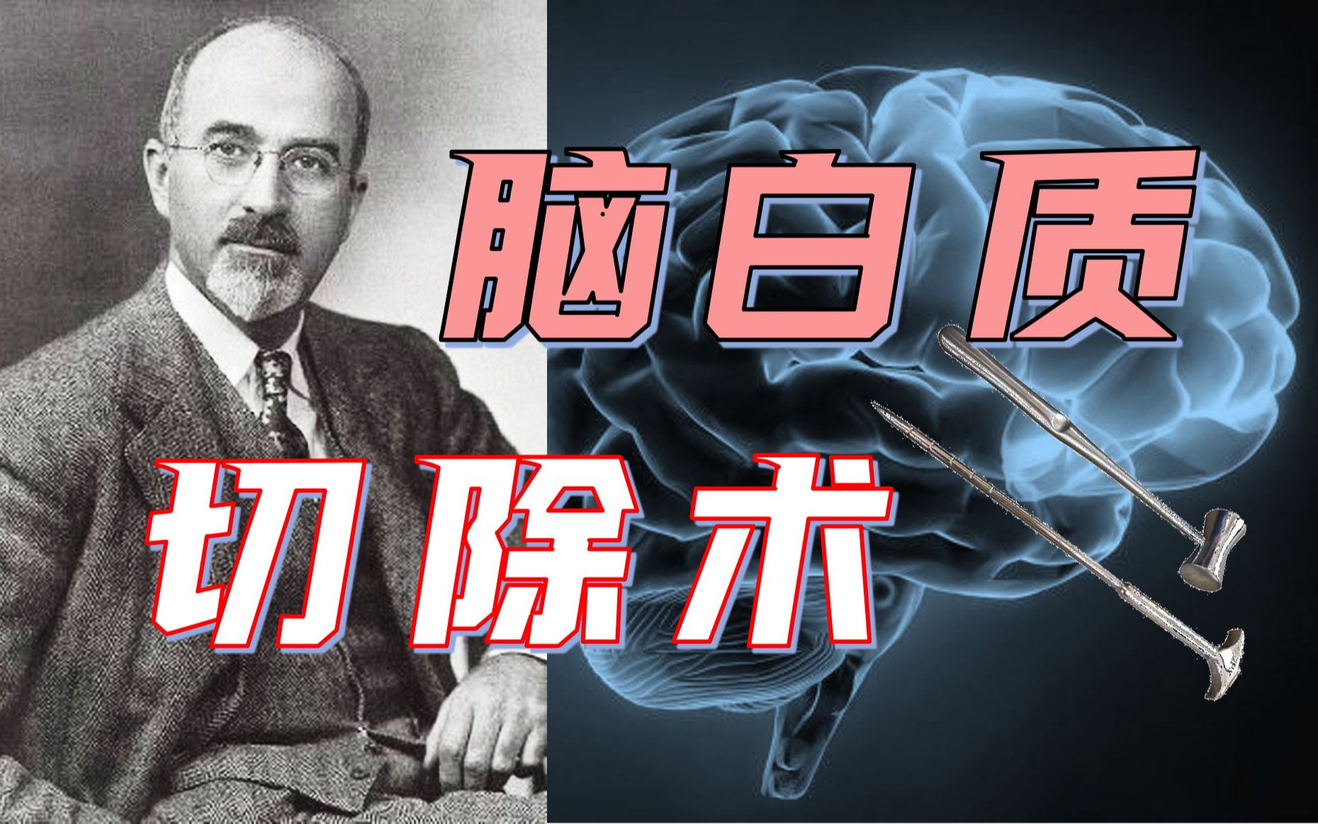 [图]【科学八卦史】一个精神病医生是怎么酿成近代最大医学惨剧的