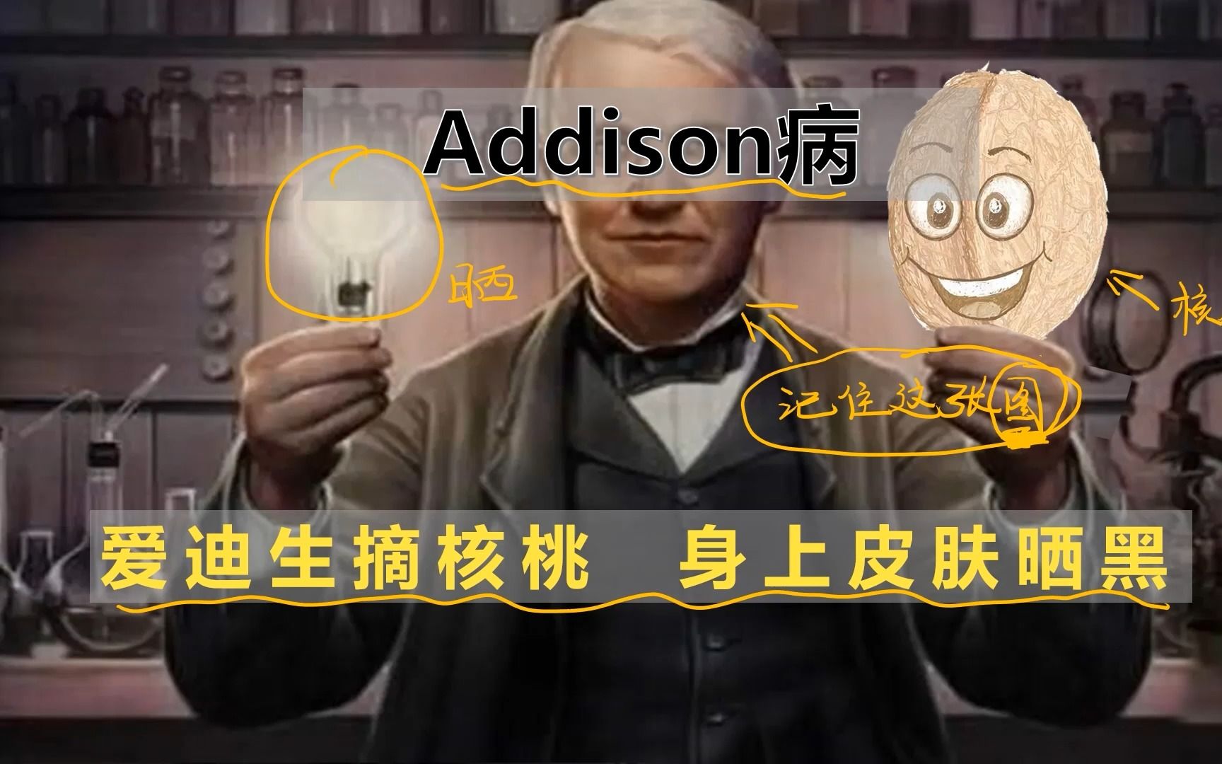 艾迪生病【Addison病】一张图一句话 记住一个病【执业医师、助理医师、考研西医综合】哔哩哔哩bilibili