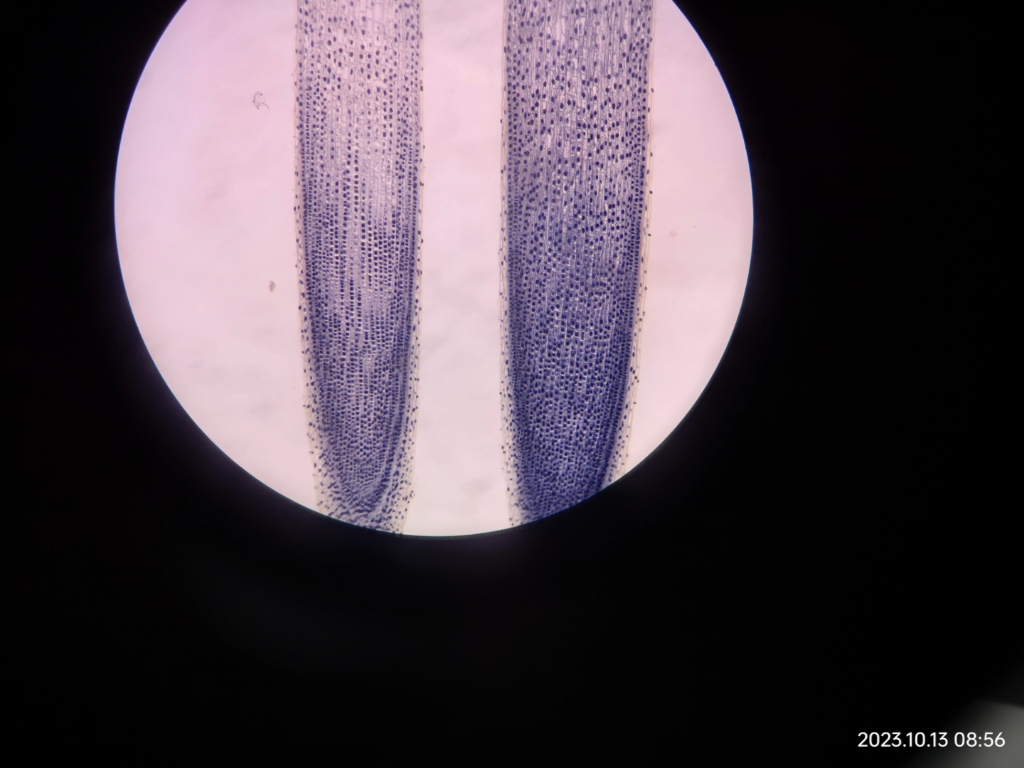 洋葱根尖细胞前期图片