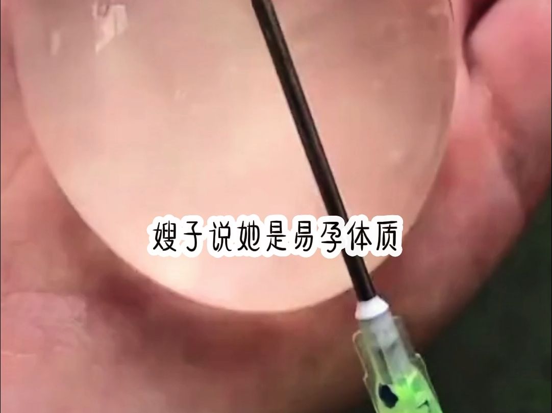 [图]#别样计谋—嫂子说她是易孕体质，刚出月子又怀上了。我向她科普剖腹产后两年内没恢复好，再怀孕可能会爆宫。好看的小说推荐。