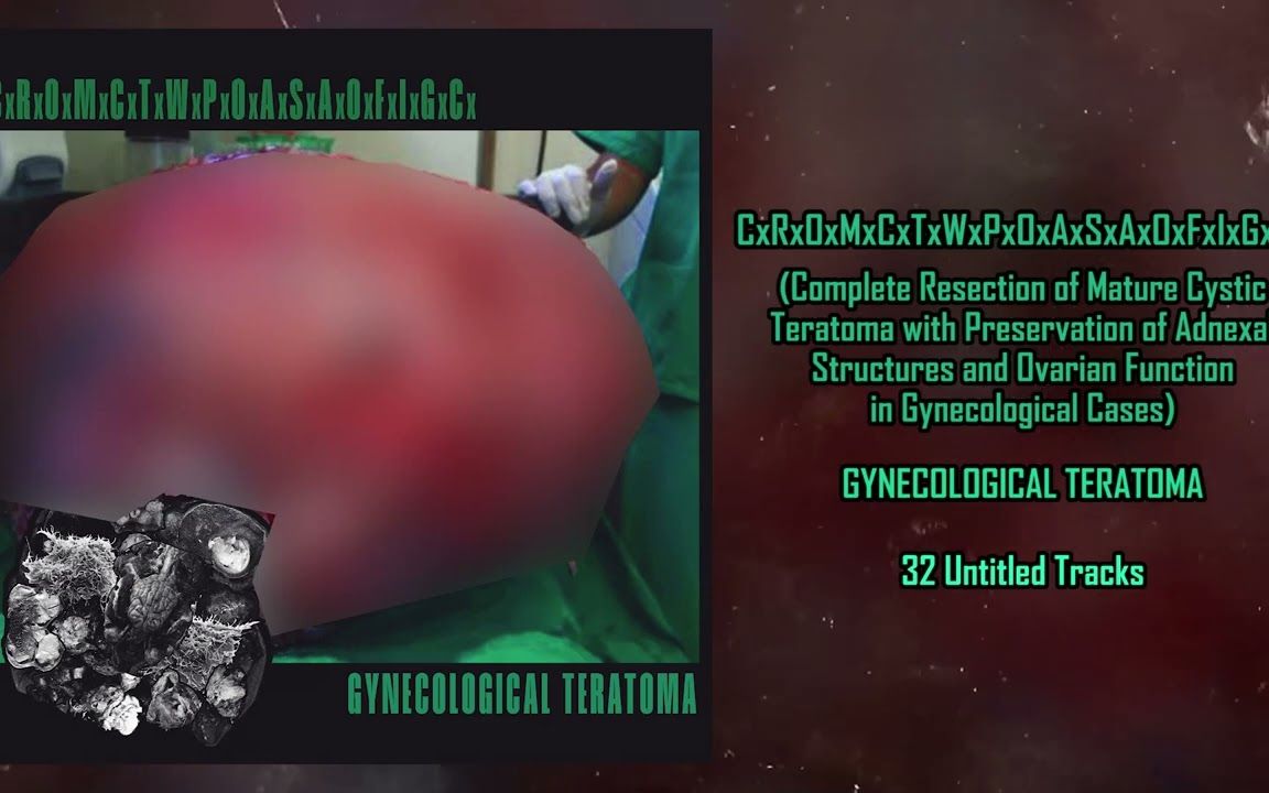 美国血噪音CxRxOxMxCxTxWxPxOxAxSxAxOxFxIxGxCx  Gynecological Teratoma(2023)Full Album哔哩哔哩bilibili