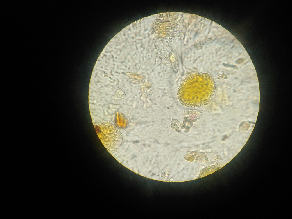 浙贝母粉末显微图图片