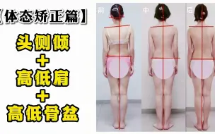 Download Video: 【体态矫正篇】头侧倾+高低肩+高低骨盆！