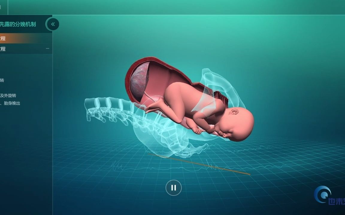 极倍职教医学类分娩过程软件演示哔哩哔哩bilibili