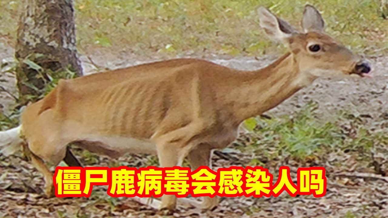 美国检测出"僵尸鹿"病毒,可能会传染人类?