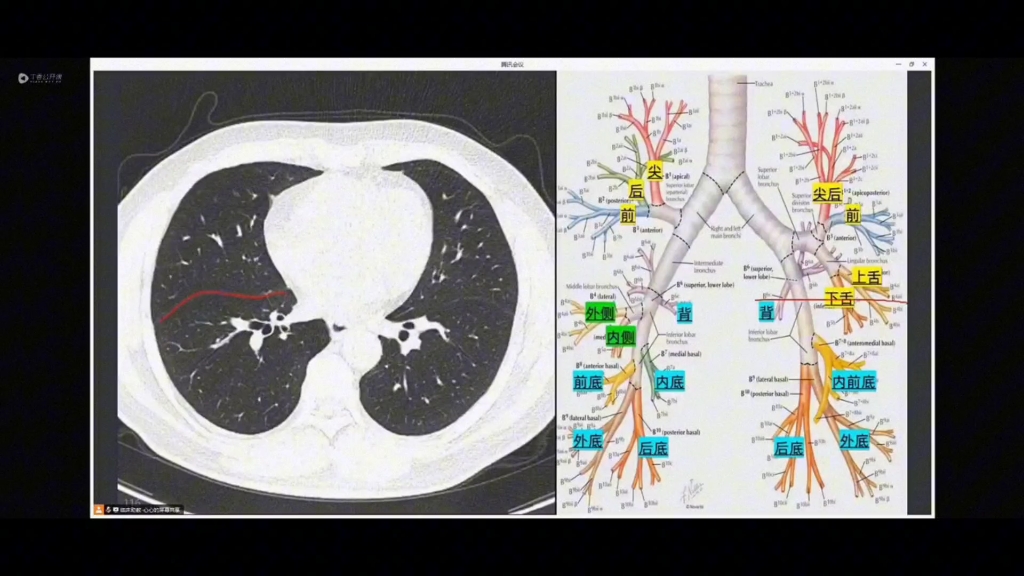 肺叶分段的CT断层解剖哔哩哔哩bilibili