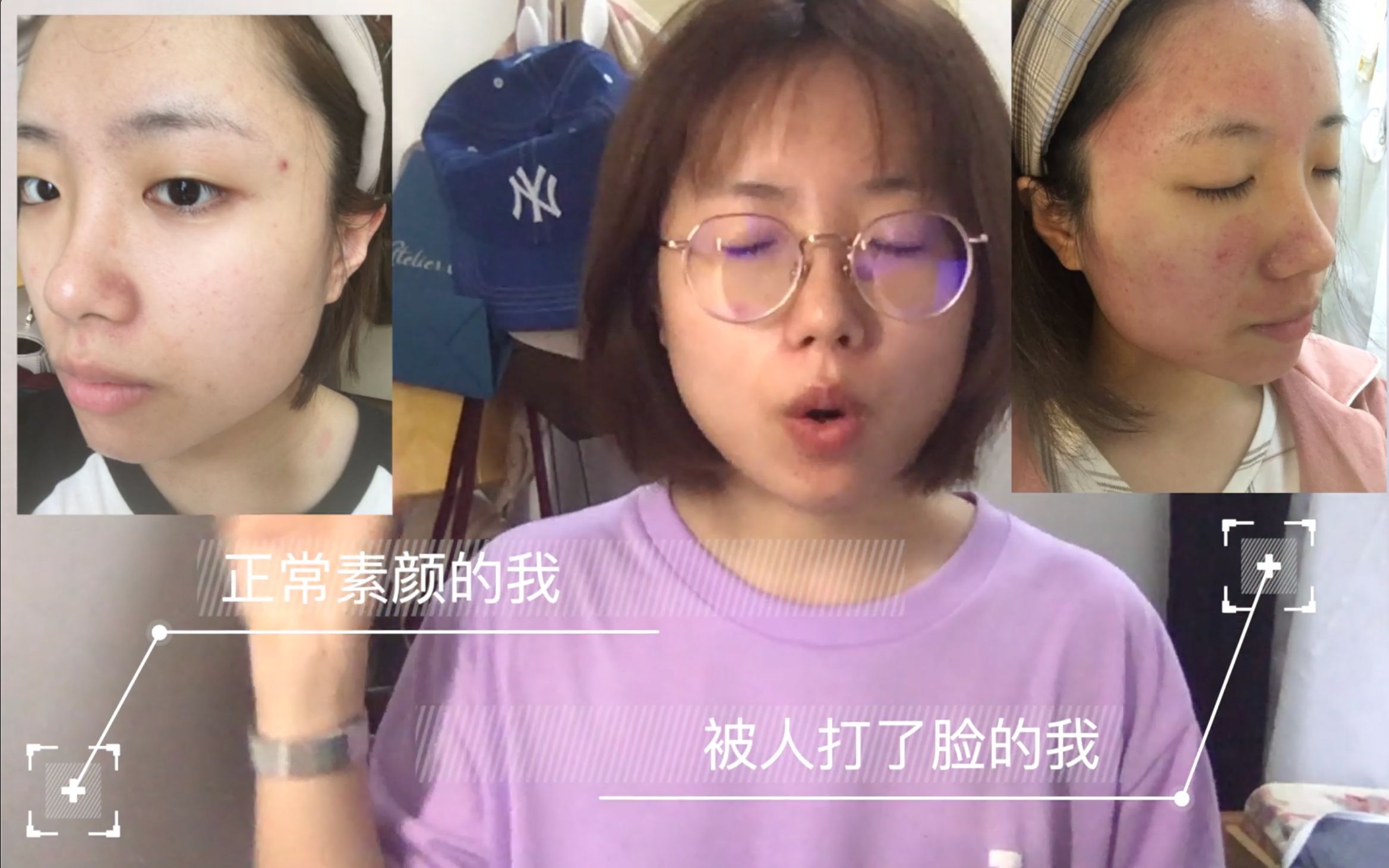 【这不是推广】易科美的伤心反馈 | 为fancl做一次自来水哔哩哔哩bilibili