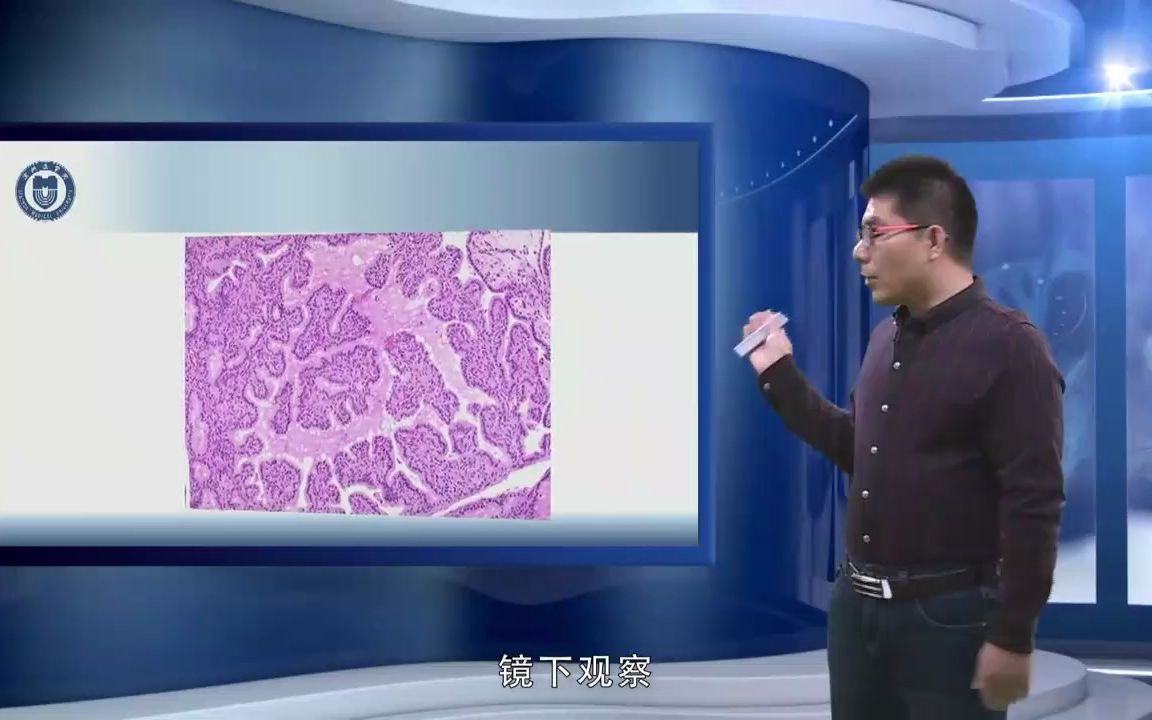 [图][11.1.2] 弥漫性毒性甲状腺肿