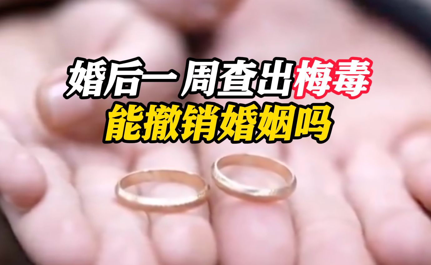 婚后一周男方查出梅毒 女方起诉撤销婚姻 法院:支持!哔哩哔哩bilibili