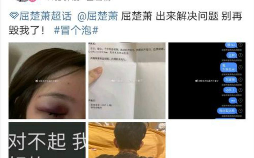 [图]屈楚萧疑似再次家暴，女友堕胎后遭男方抛弃，抑郁成疾欲轻生【疑似屈楚萧女友晒瘀伤照 自曝遭殴打导致流产】随后删博解释：是他朋友打的