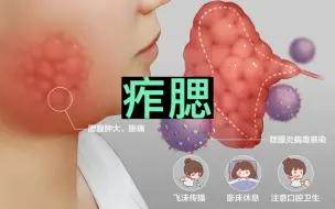 Download Video: 流行性腮腺炎