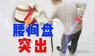 Descargar video: 【腰椎间盘突出】康复训练，几个简单高效的训练动作