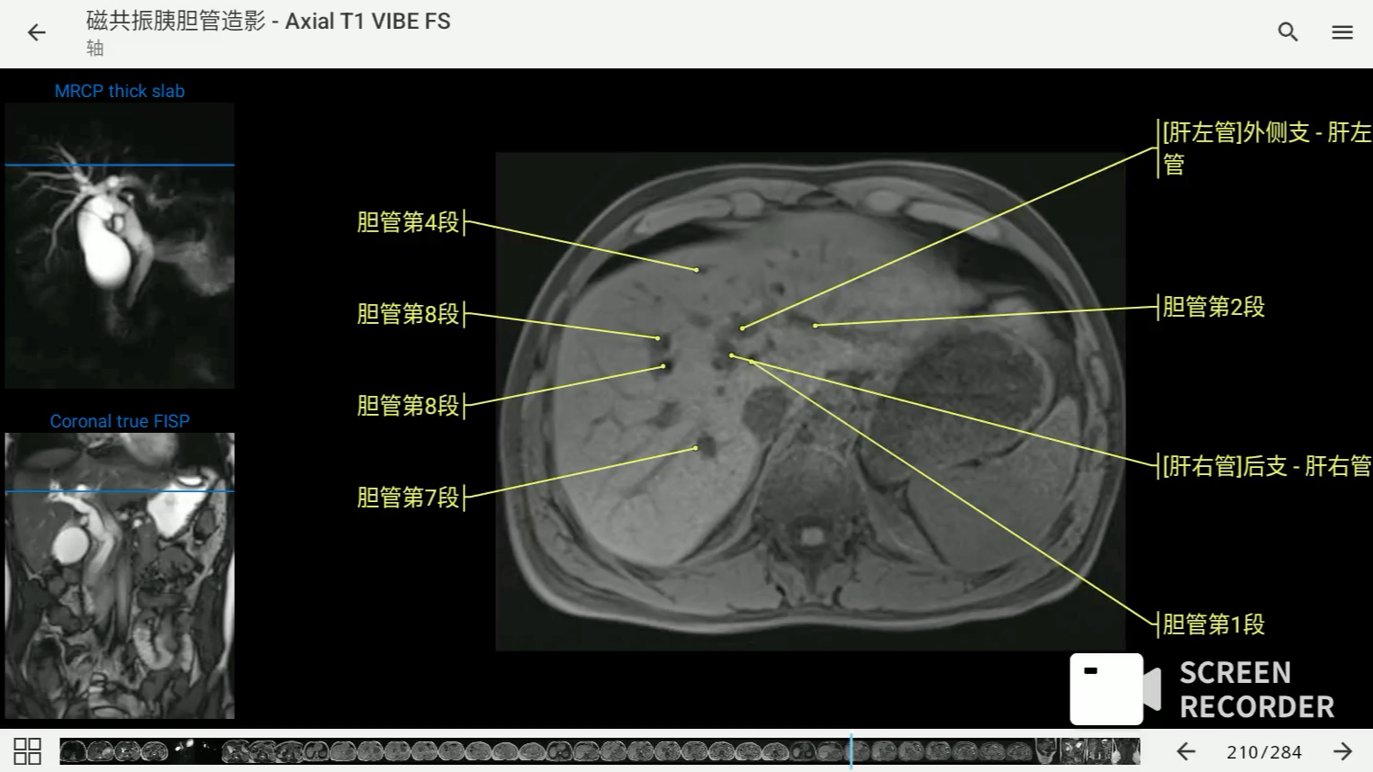 影像解剖图谱神器 医学影像学必备 eanatomy中文最新版 磁共振胆管造影哔哩哔哩bilibili