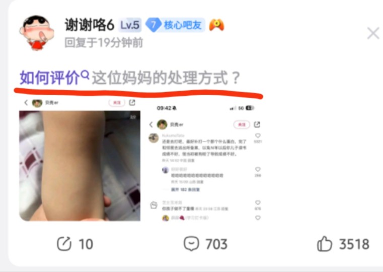 离谱美集,宝宝被狗咬,遇事先发小红薯哔哩哔哩bilibili