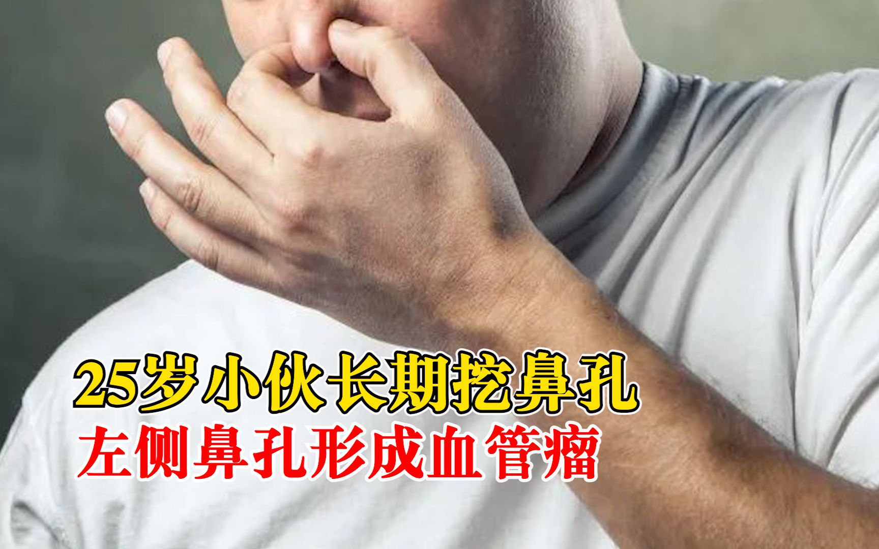 [图]25岁小伙长期挖鼻孔形成血管瘤：鼻血像流水，半小时止不住