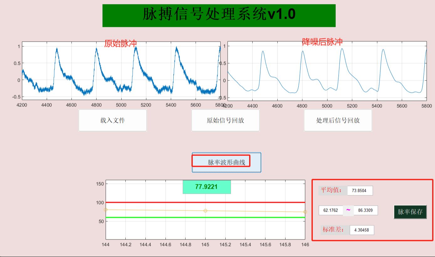 275基于matlab的脉搏信号处理GUI界面编程,并实现滤波、去噪、实时回放、小波分析 计算脉率.哔哩哔哩bilibili