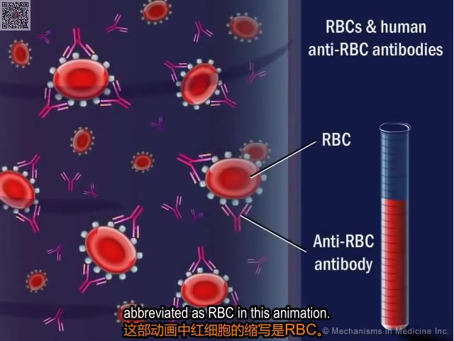 2分钟动画帮你搞懂抗球蛋白试验原理(中英文字幕)哔哩哔哩bilibili