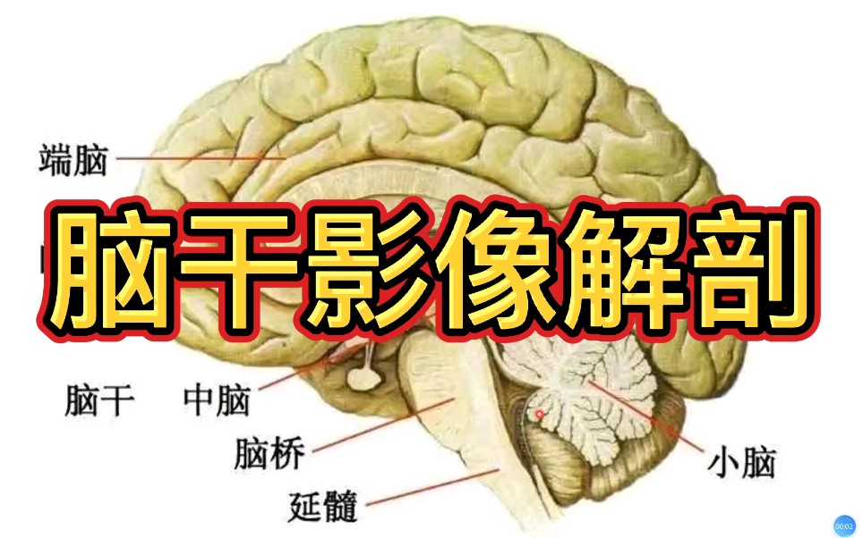 影像基础:脑干影像解剖分享,放射科医生讲解!哔哩哔哩bilibili