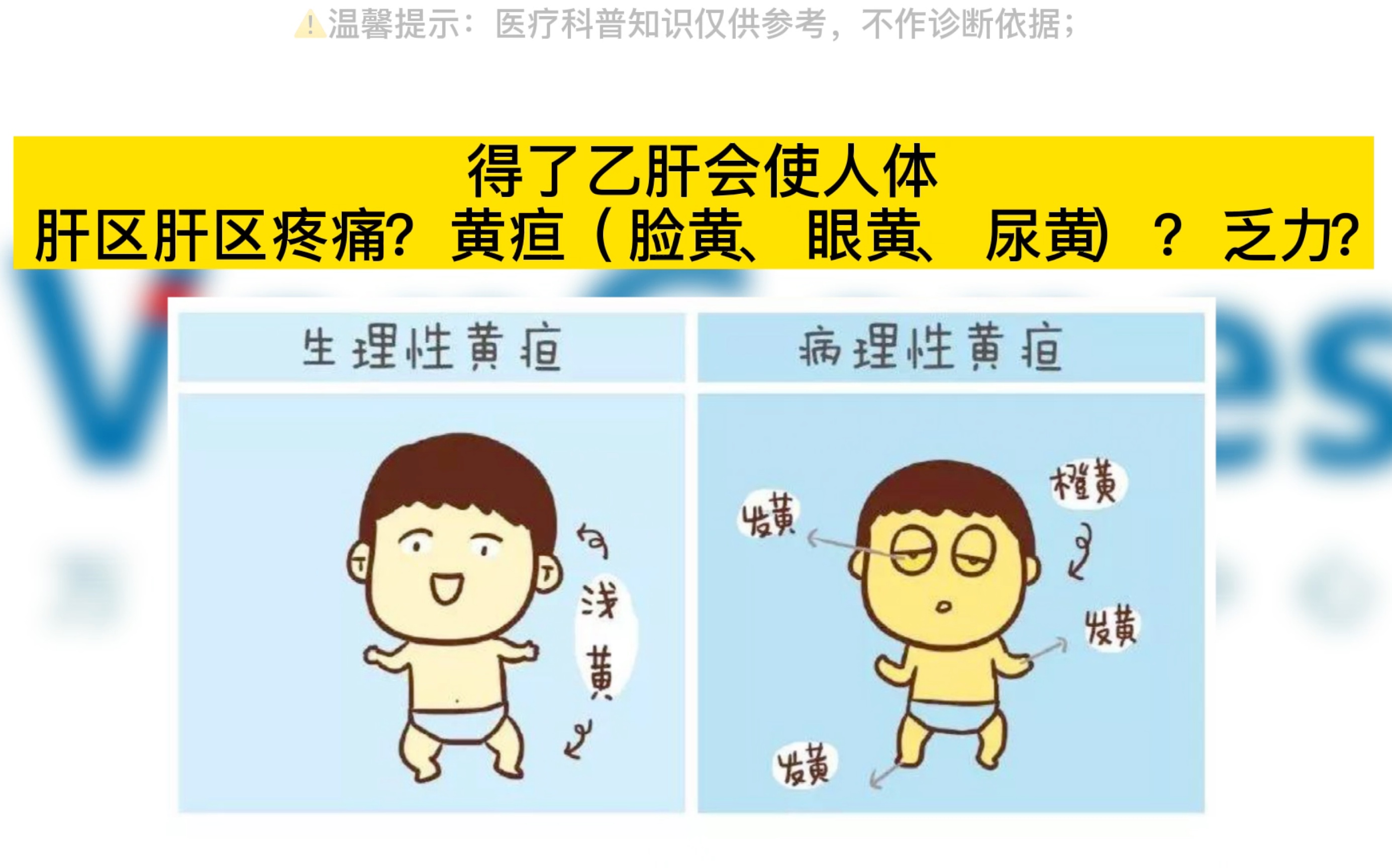 得了乙肝会 肝区肝区疼痛?黄疸(脸黄,眼黄,尿黄)?乏力?