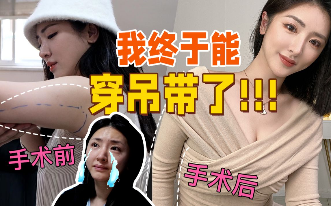 [图]【手臂吸脂vlog】90斤的体重 120的手臂，美女也怕金刚臂啊！