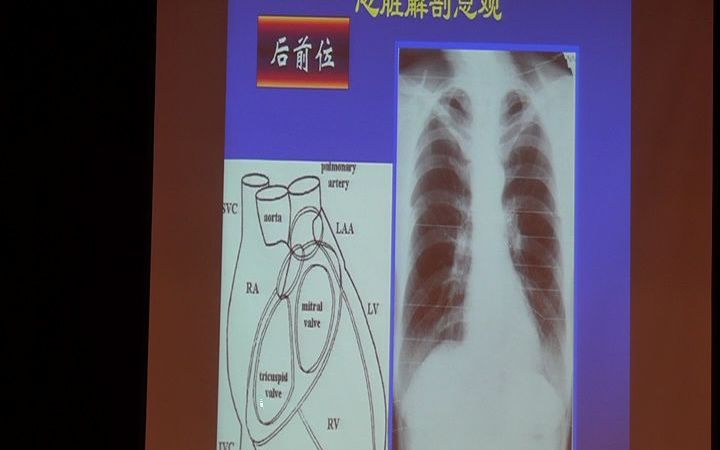 心脏解剖及影像1.mp4哔哩哔哩bilibili