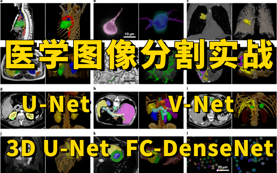 基于UNet的医学图像分割实战,3D UNet\VNet\FCDenseNet全详解!上交大博士带你从零入门图像分割!哔哩哔哩bilibili