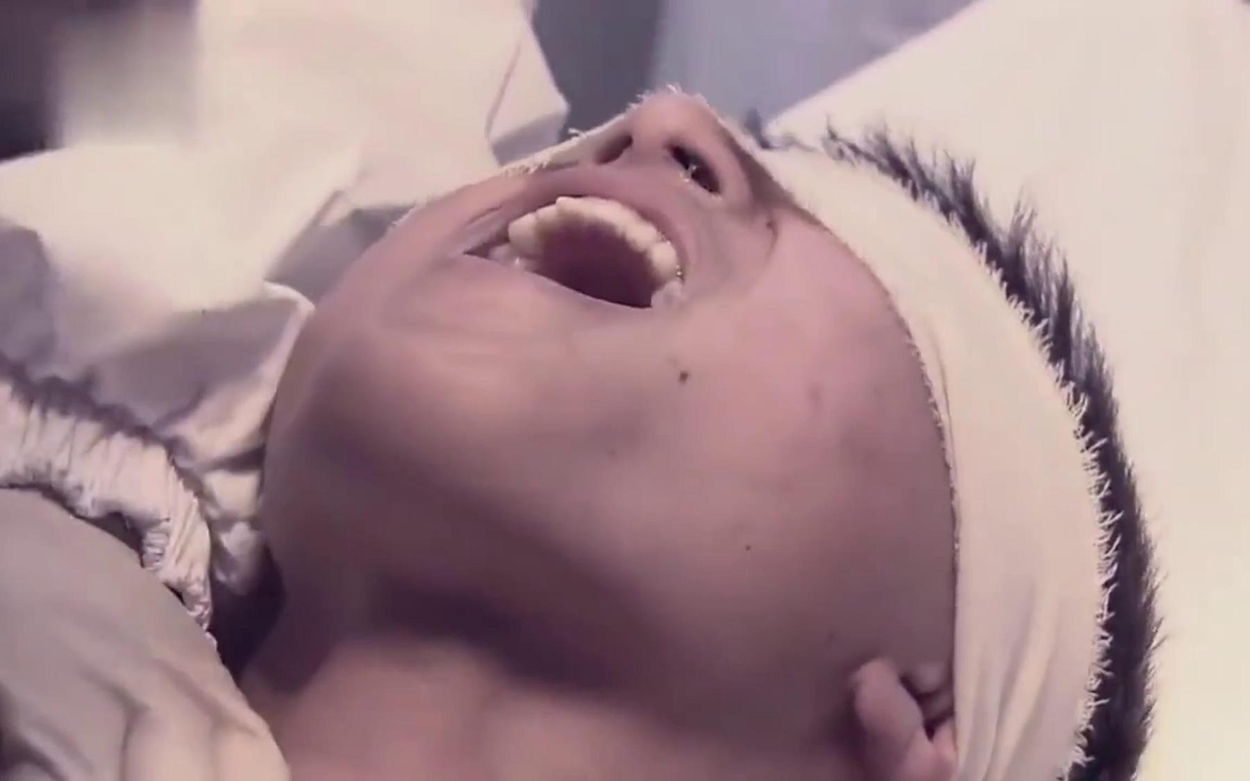 红雪：鬼子拿男孩做细菌研究，男孩痛得惨叫连连，毫无人性！