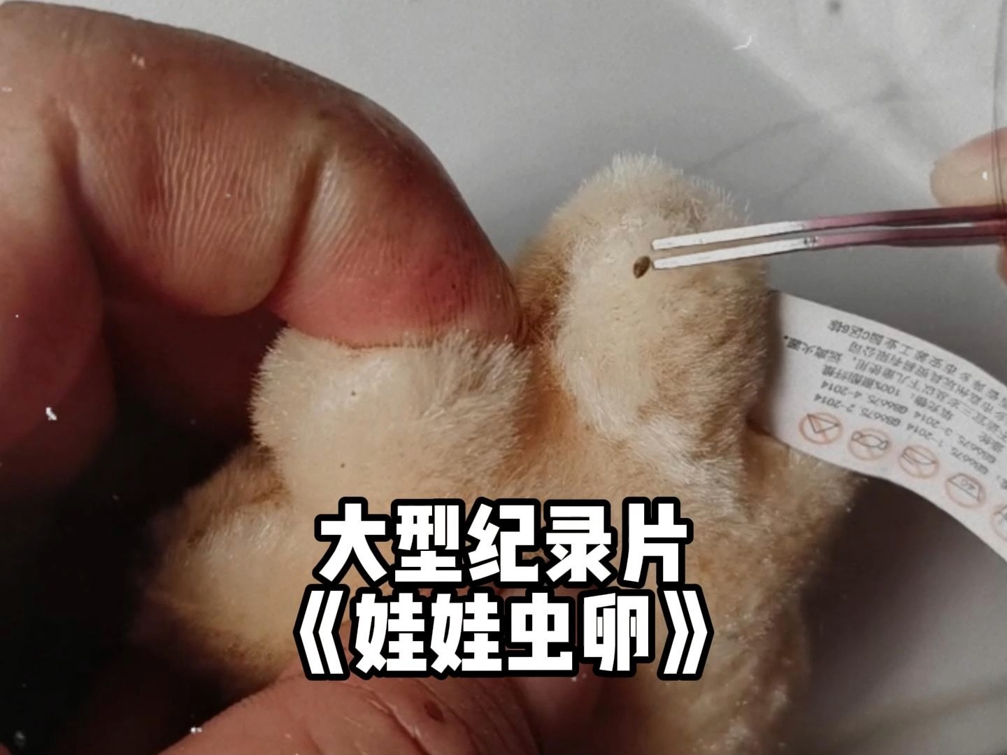 大型纪录片《娃娃虫卵》