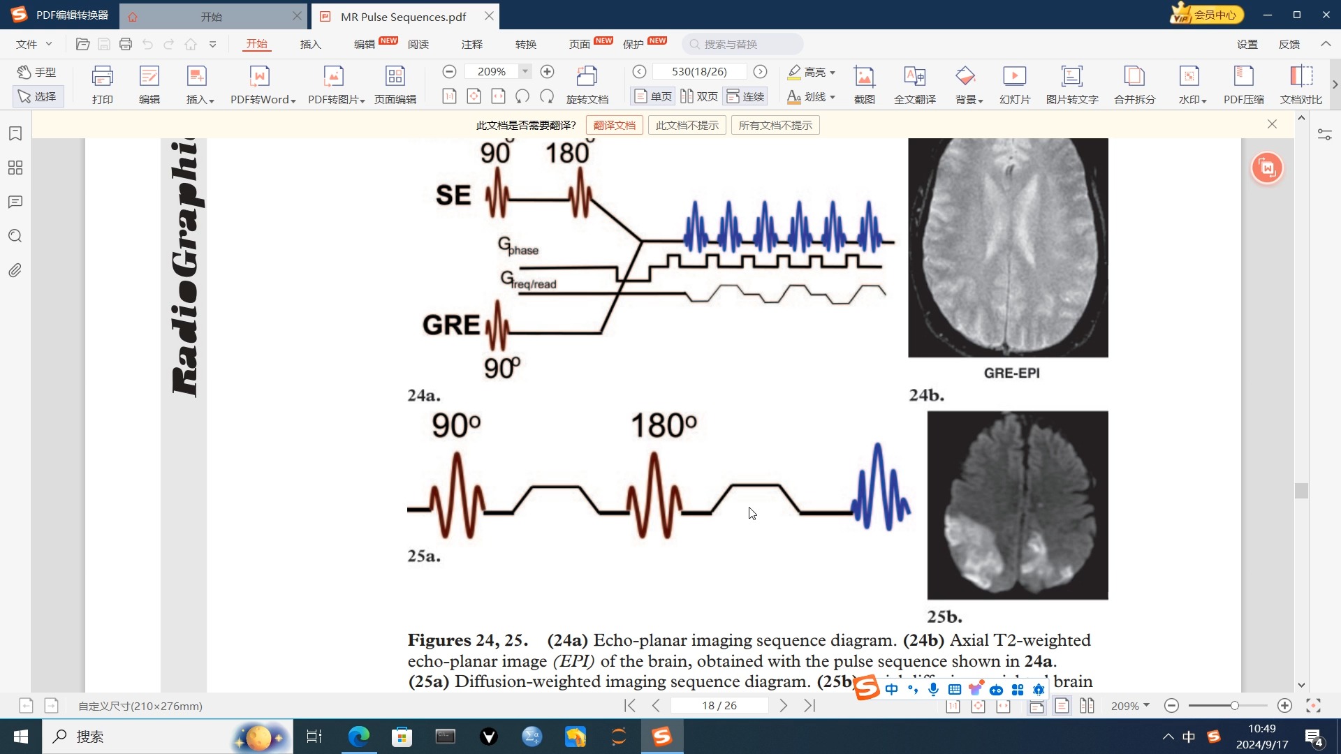 影像医生必须了解之EPI、DWI、ADC 磁共振成像原理 What Every Radiologist Wants to Know but... 4哔哩哔哩bilibili