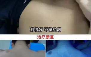 Download Video: 兰州哪个医院看白癜风好 怎么治疗散发型白癜风效果好-兰州中研