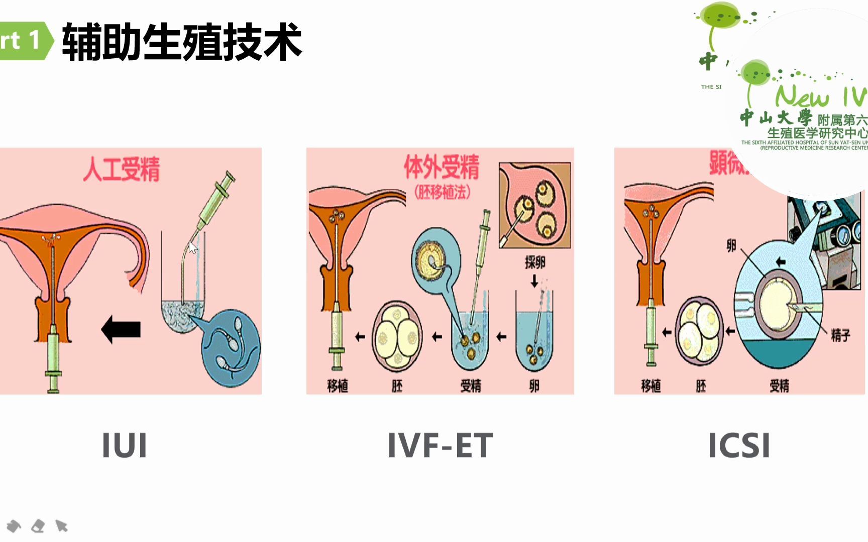 中山大学附属第六医院宣教视频哔哩哔哩bilibili