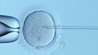 线虫的显微注射 哔哩哔哩 Bilibili