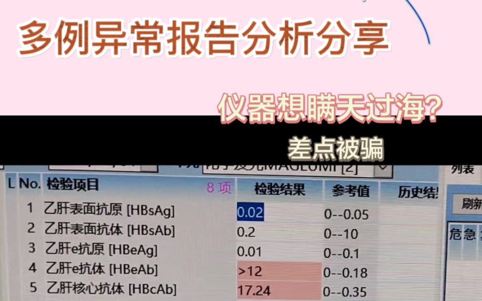 [图]检验报告｜异常存疑★推理，xiao软管暗中作祟，害我加班！害我加班！霉运退退退