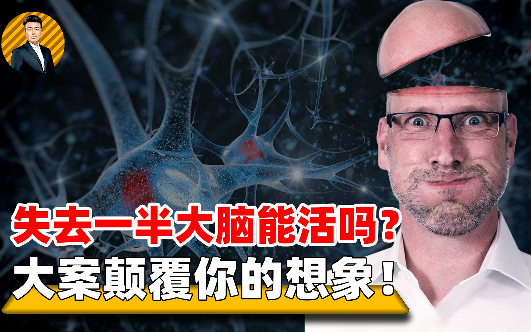 [图]失去一半大脑人能活吗？英国天才被查出没大脑，身体机制超出想象