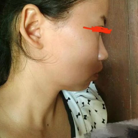 耳骨外翻的女人图片图片